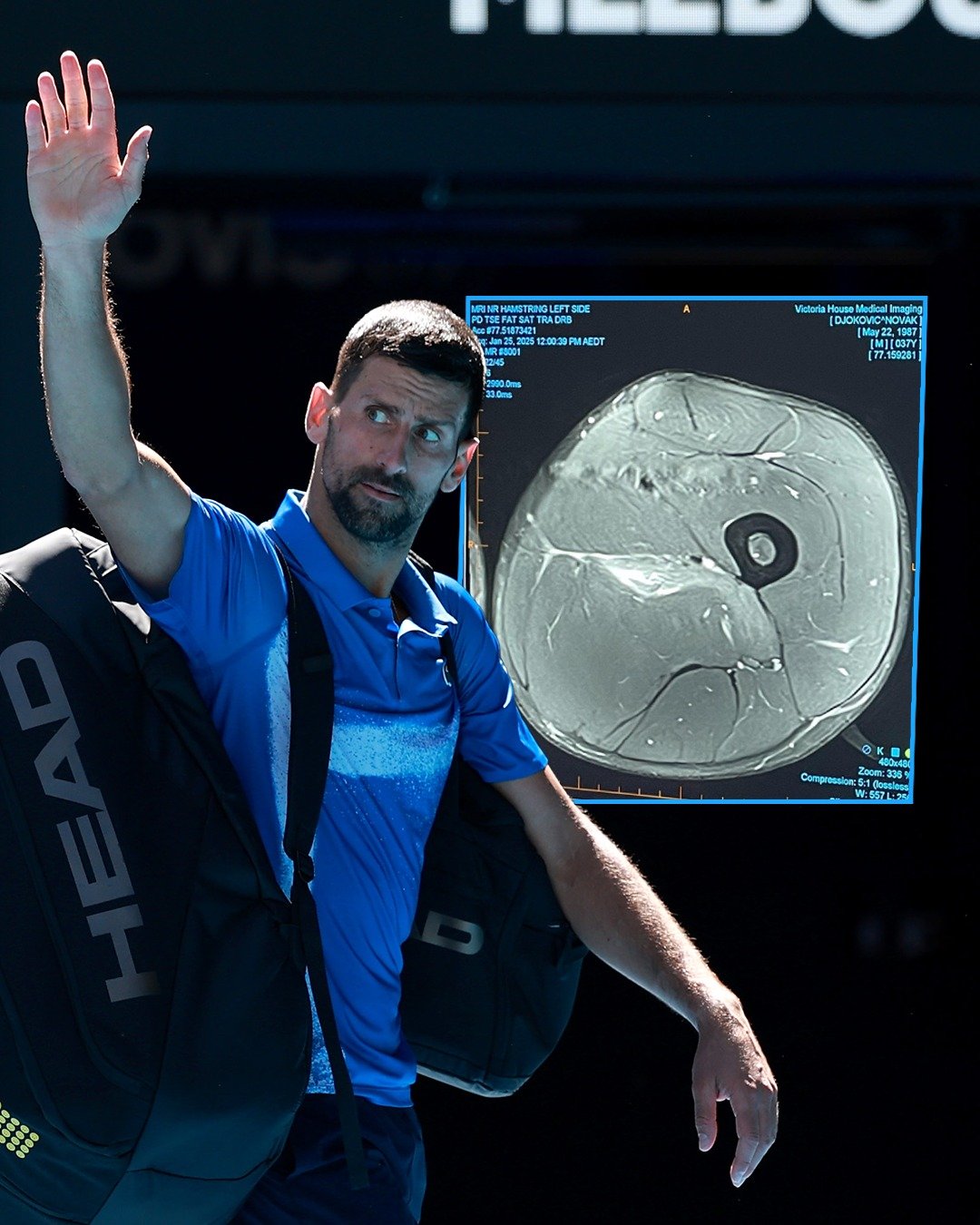 德约科维奇遭遇七持续失利，尤文图斯教练压力巨大！